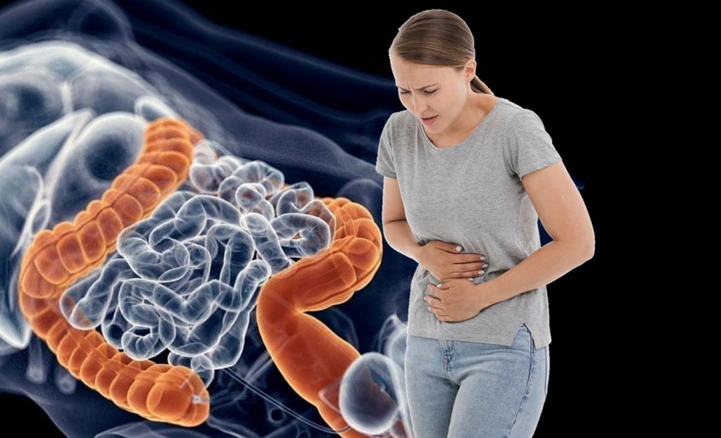 Dietistas, alimentación saludable, dieta, enfermedad de crohn, colitis Dieta para la colitis o la enfermedad de crohn